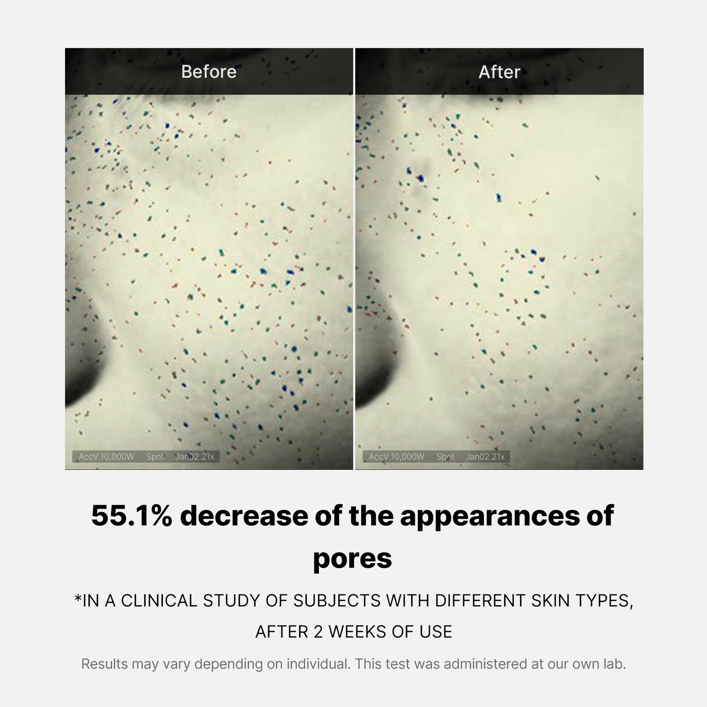 zero-pore-one-day-cream-q3 04_3616addc-f184-4deb-a5d7-e3a782e4713d.jpg