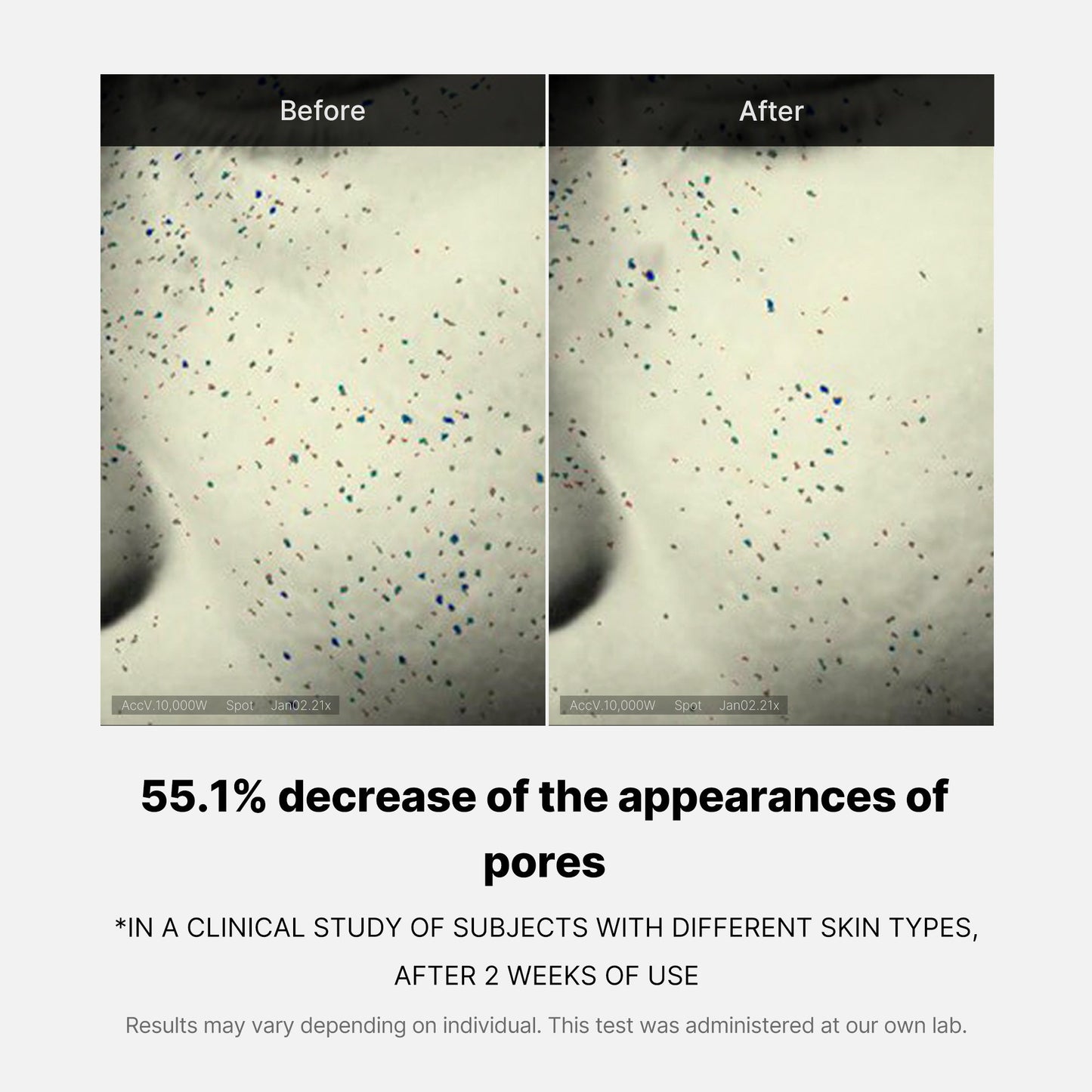 pore-care-duo-h0 05_12ddab8a-64be-4612-8ee1-27e5ec701921.jpg