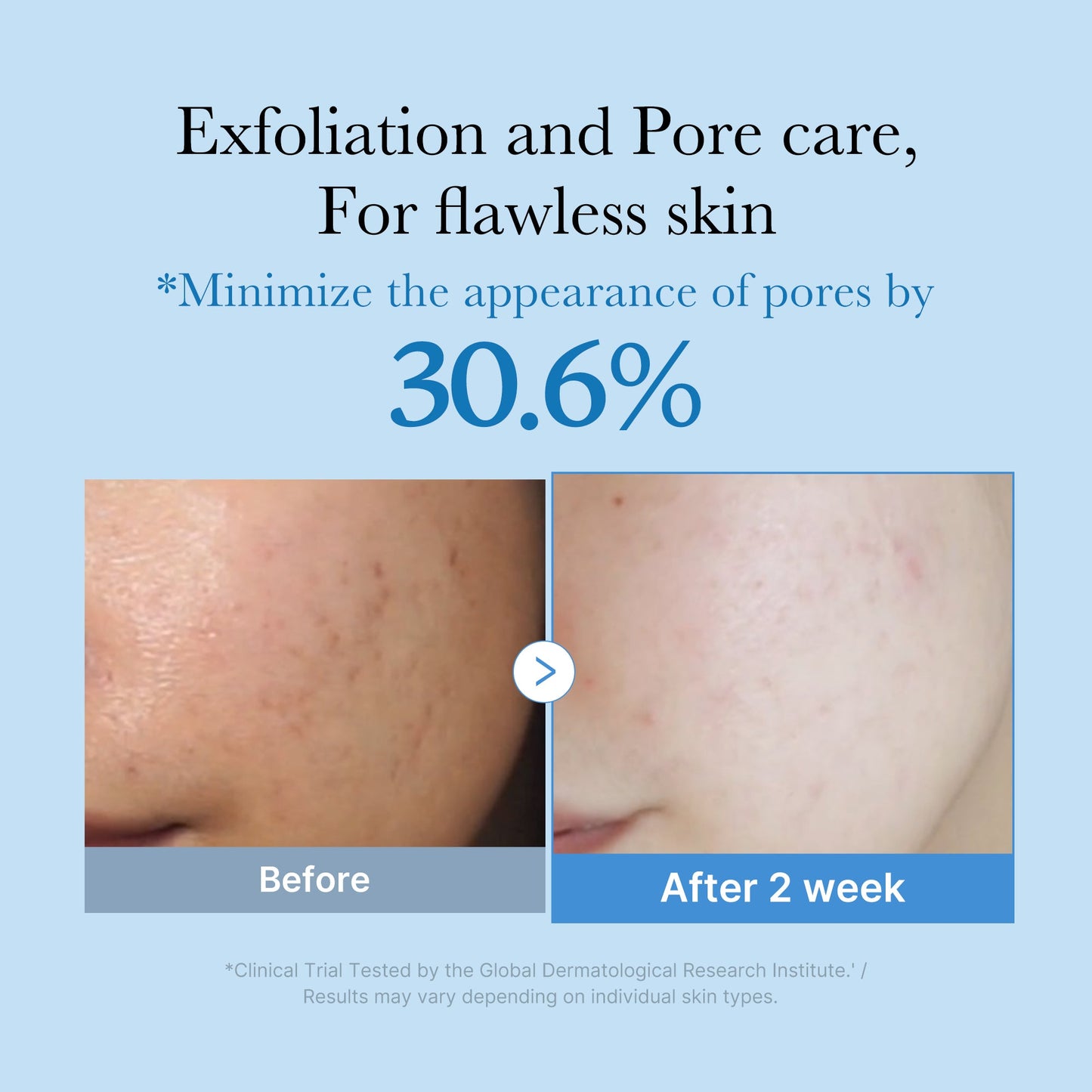 zero-pore-toner-r7 01_d6480b4e-3c08-4954-994a-ed5212c1839c.jpg