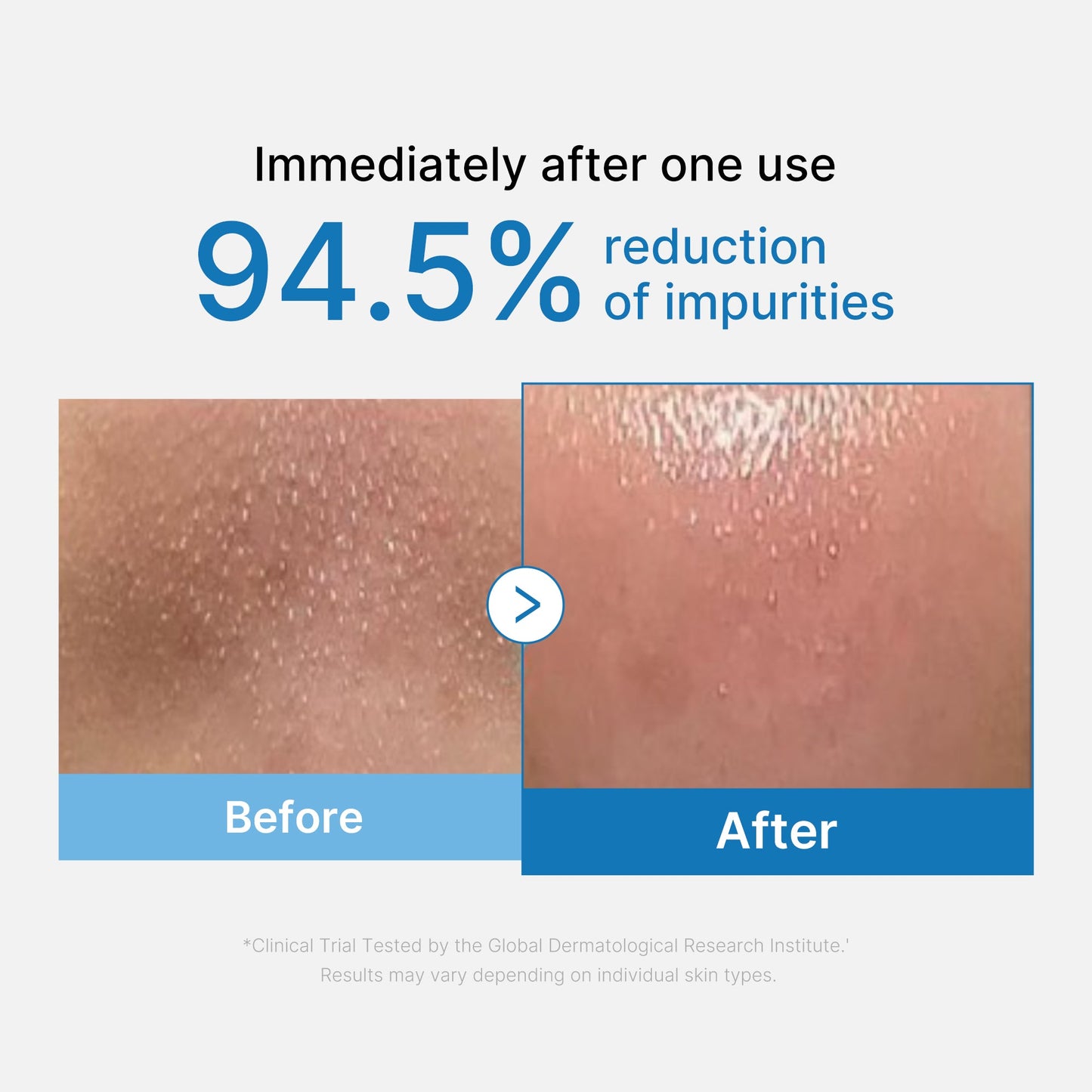 zero-pore-blackhead-deep-cleansing-oil-l1 01_eed557ec-5857-46a2-8b17-dbd67c692dcb.jpg