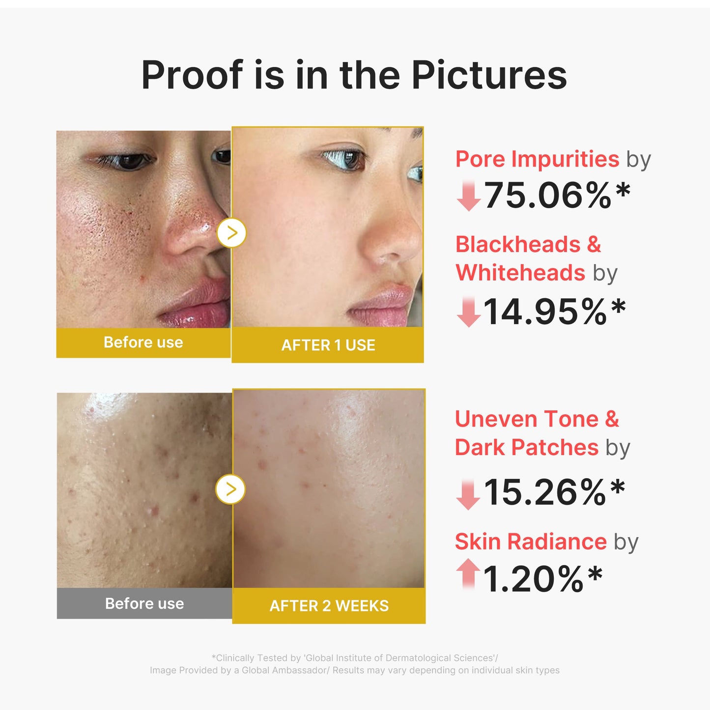 kojic-acid-turmeric-peel-shot-j5 02_45fe66d3-b3f6-4100-aa52-2afd7eded417.jpg
