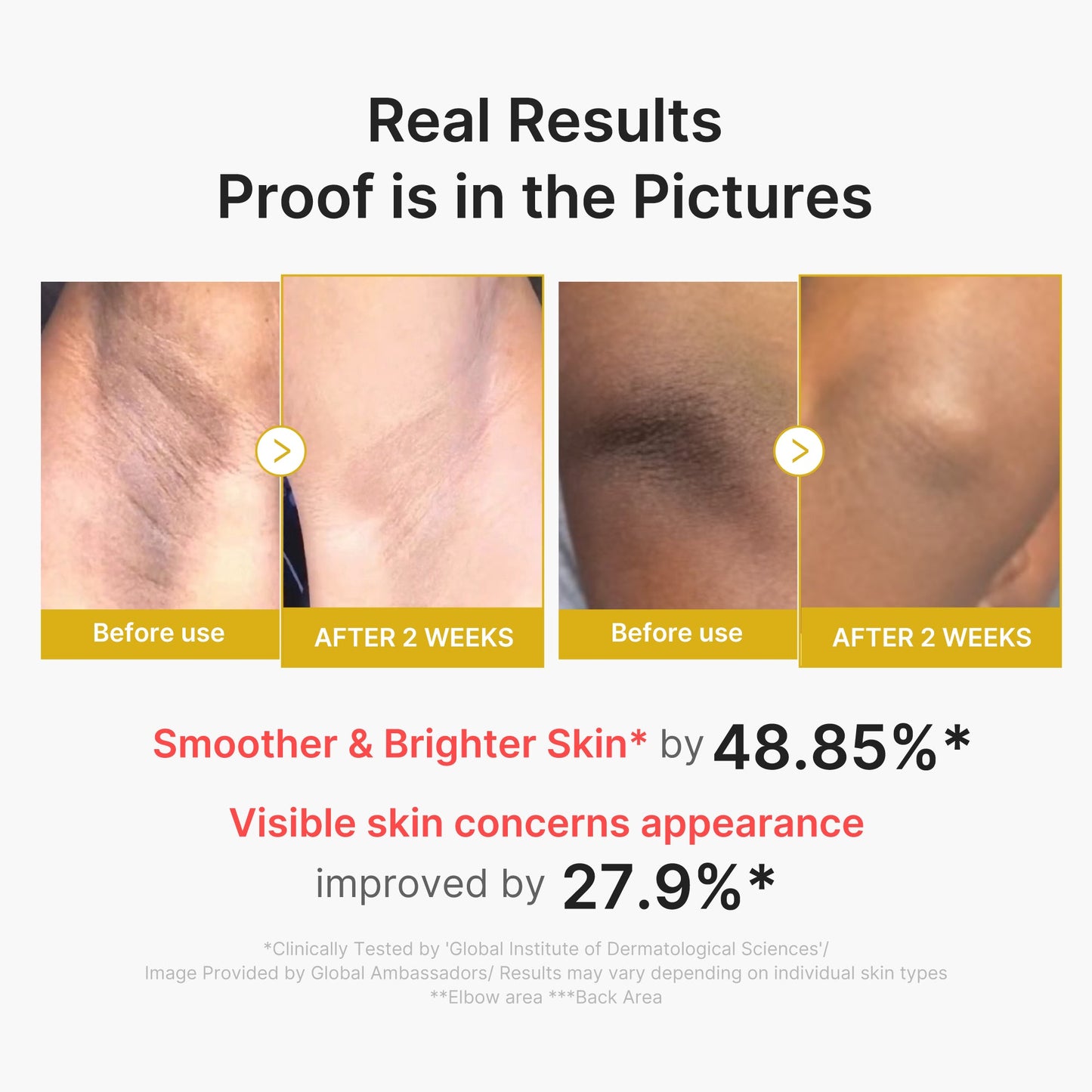 kojic-acid-turmeric-body-peel-shot-k2 02_72880cfc-382b-440b-8152-7e3dce87da2a.jpg