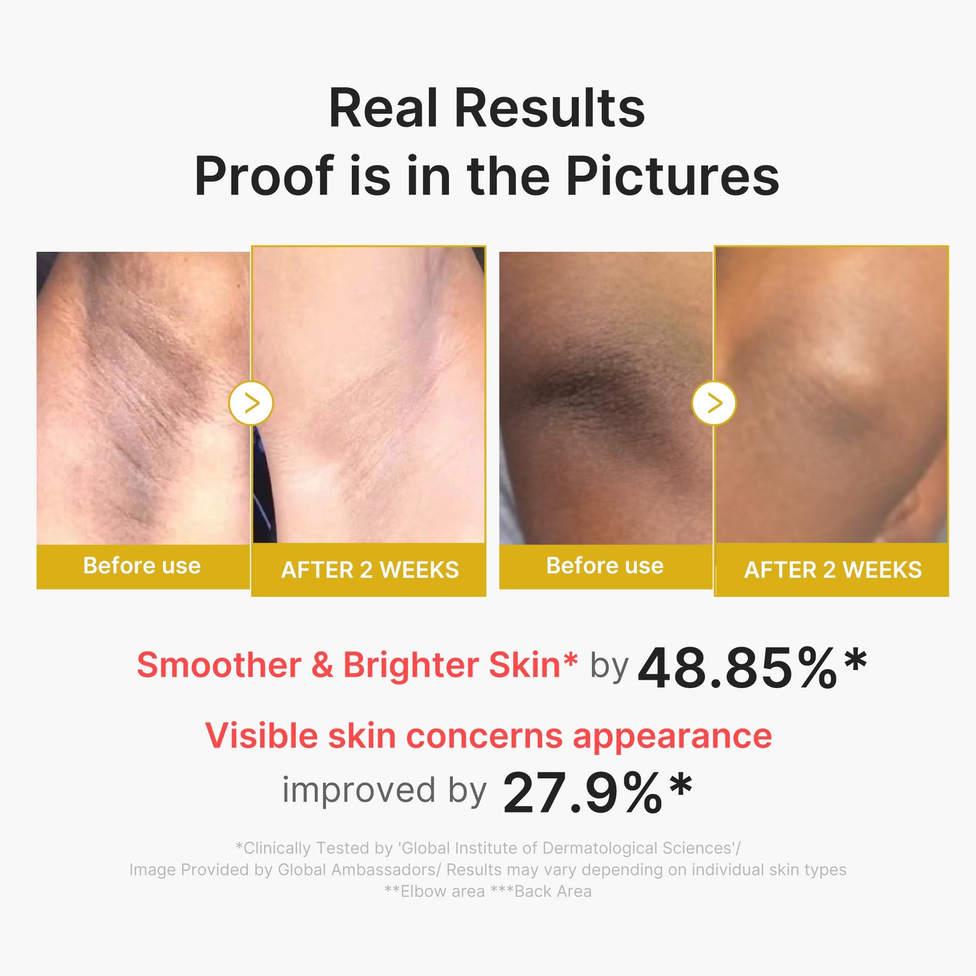 kojic-acid-turmeric-body-peel-shot-k2 02_72880cfc-382b-440b-8152-7e3dce87da2a.jpg
