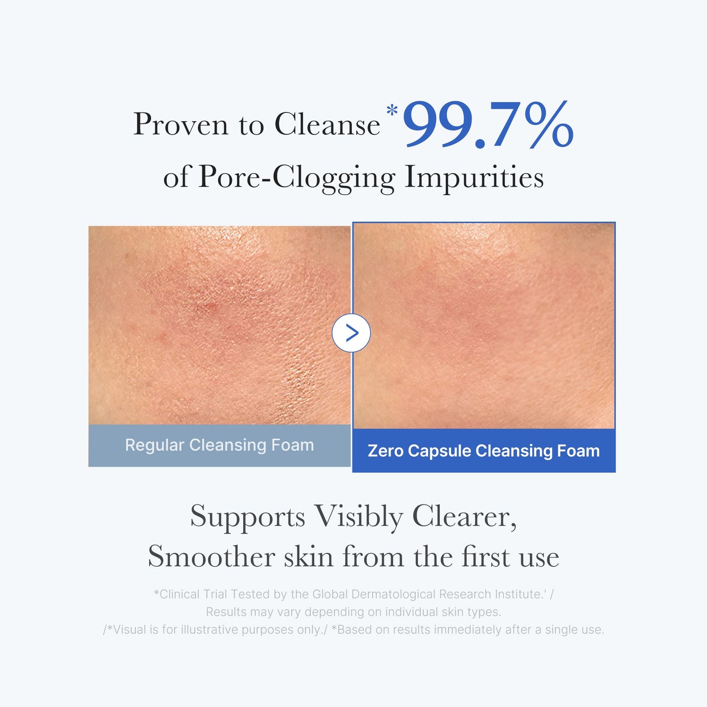 zero-pore-capsule-cleansing-foam-d7 02_c1fb9dfb-86c5-4038-8ff8-490d1006276c.jpg