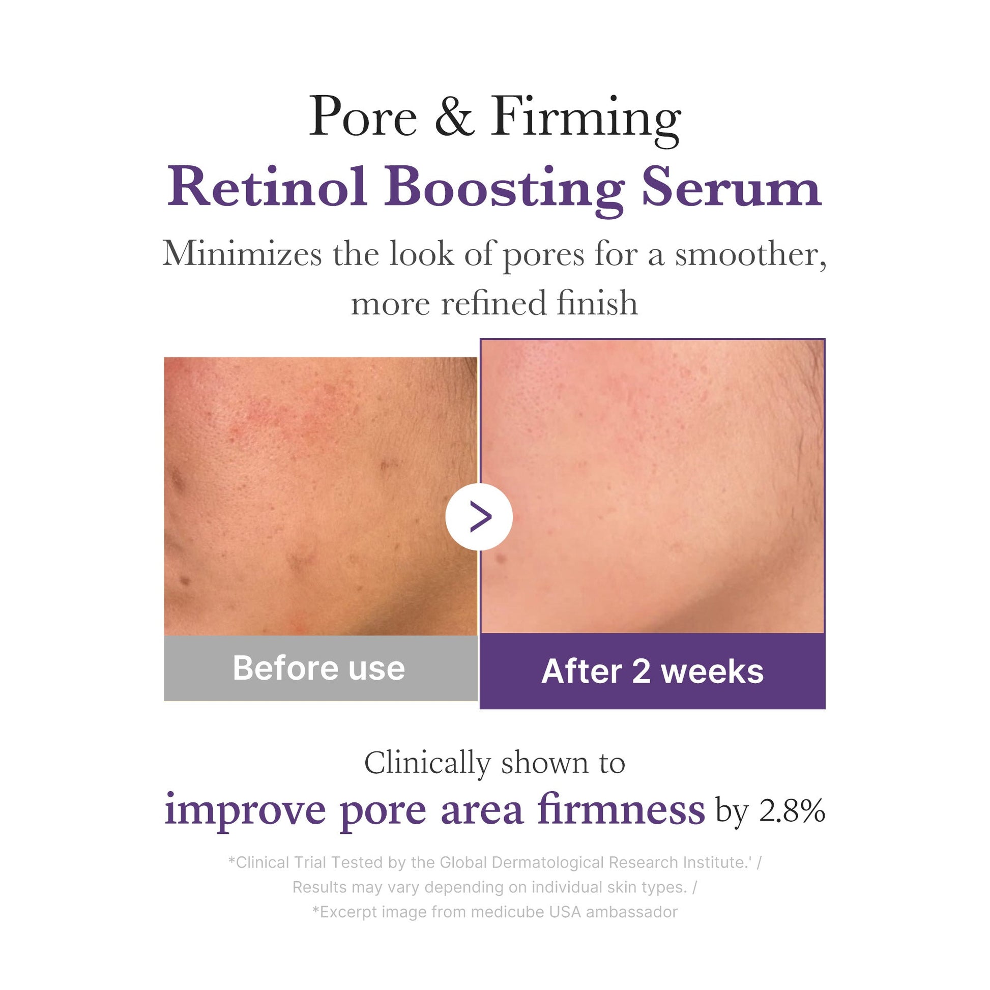 retinol-nmn-boosting-serum-n0 03_3510e7a5-5633-4a18-81ea-1389593bd517.jpg