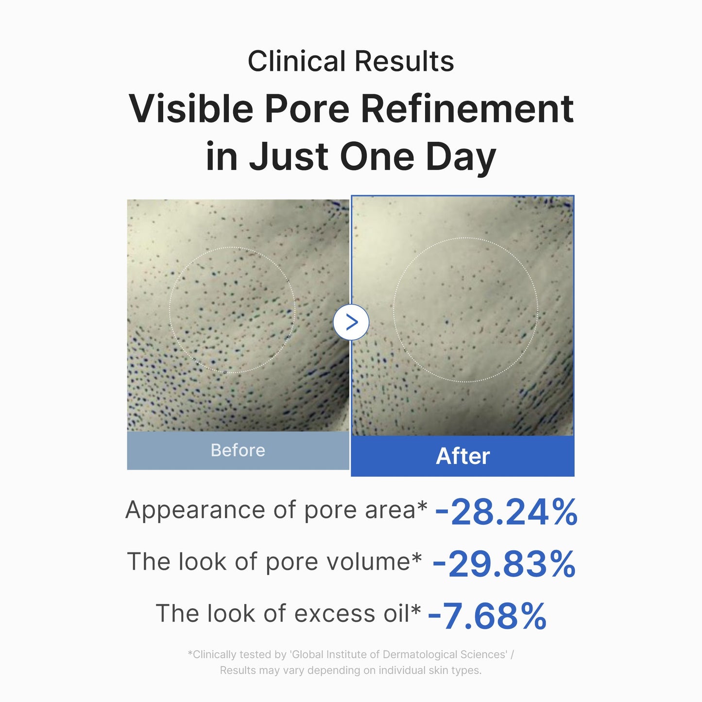 zero-pore-one-day-peptide-serum-x9 03_448eab9e-dc60-4dcb-9e4e-e863aabb61b0.jpg
