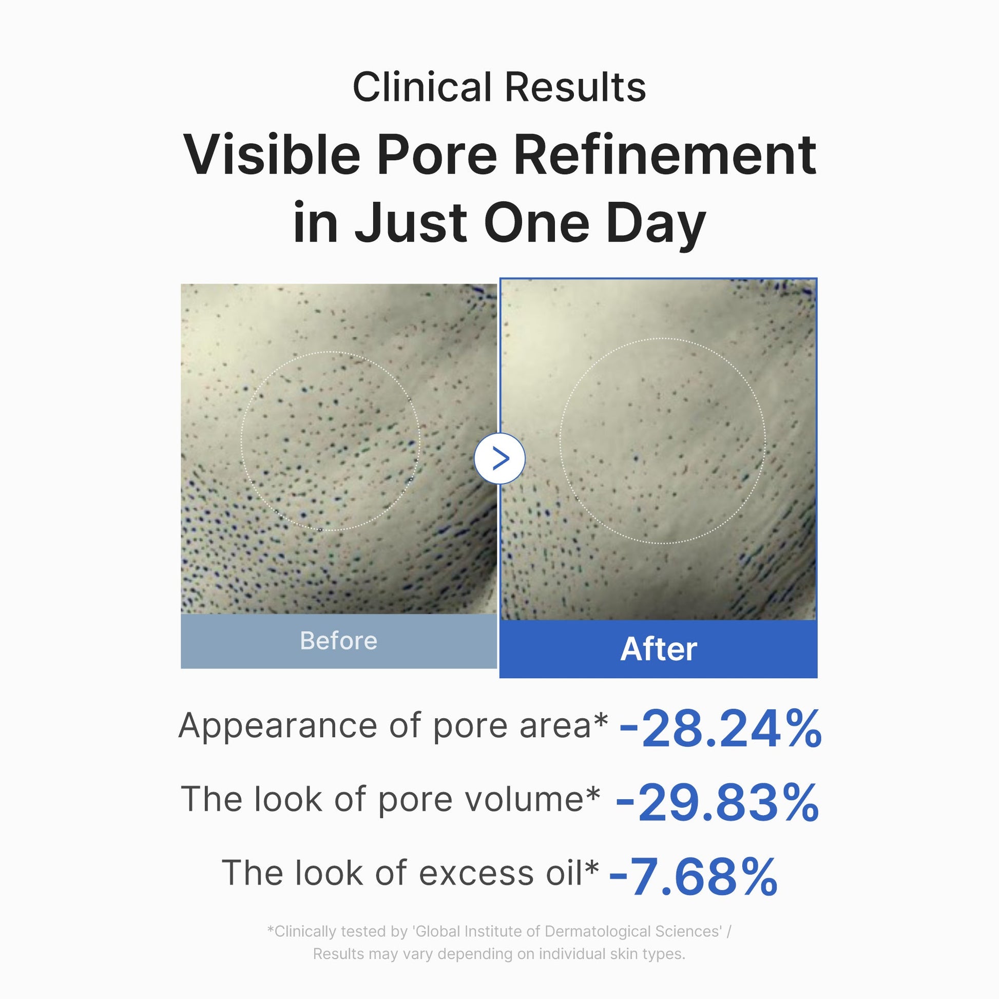 zero-pore-one-day-peptide-serum-x9 03_448eab9e-dc60-4dcb-9e4e-e863aabb61b0.jpg