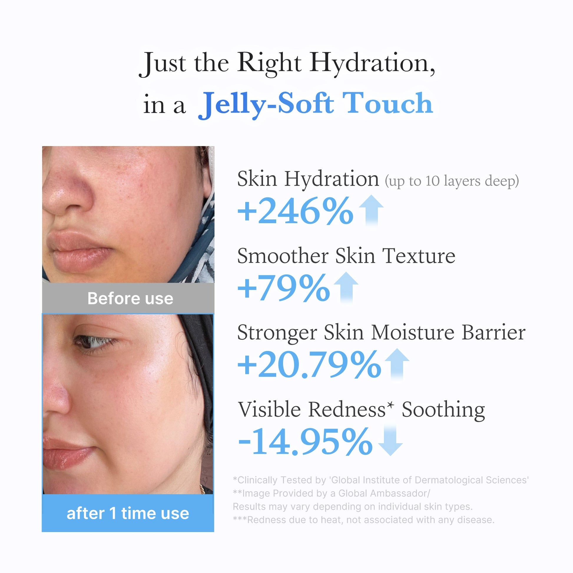 hyaluronic-ceramide-moisturizing-jelly-cream-g6 03_c39d66cc-0839-4e48-ab4a-d32143d06b1c.jpg