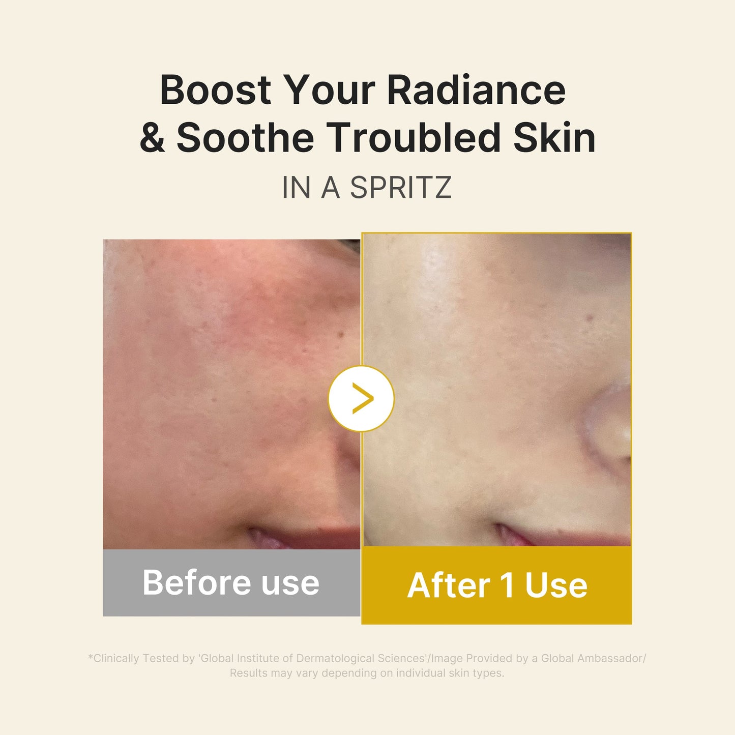 kojic-acid-turmeric-vitamin-gold-jelly-mist-serum-w1 03_dc9cd19e-4e57-49d3-9b66-c7762e8a63f1.jpg
