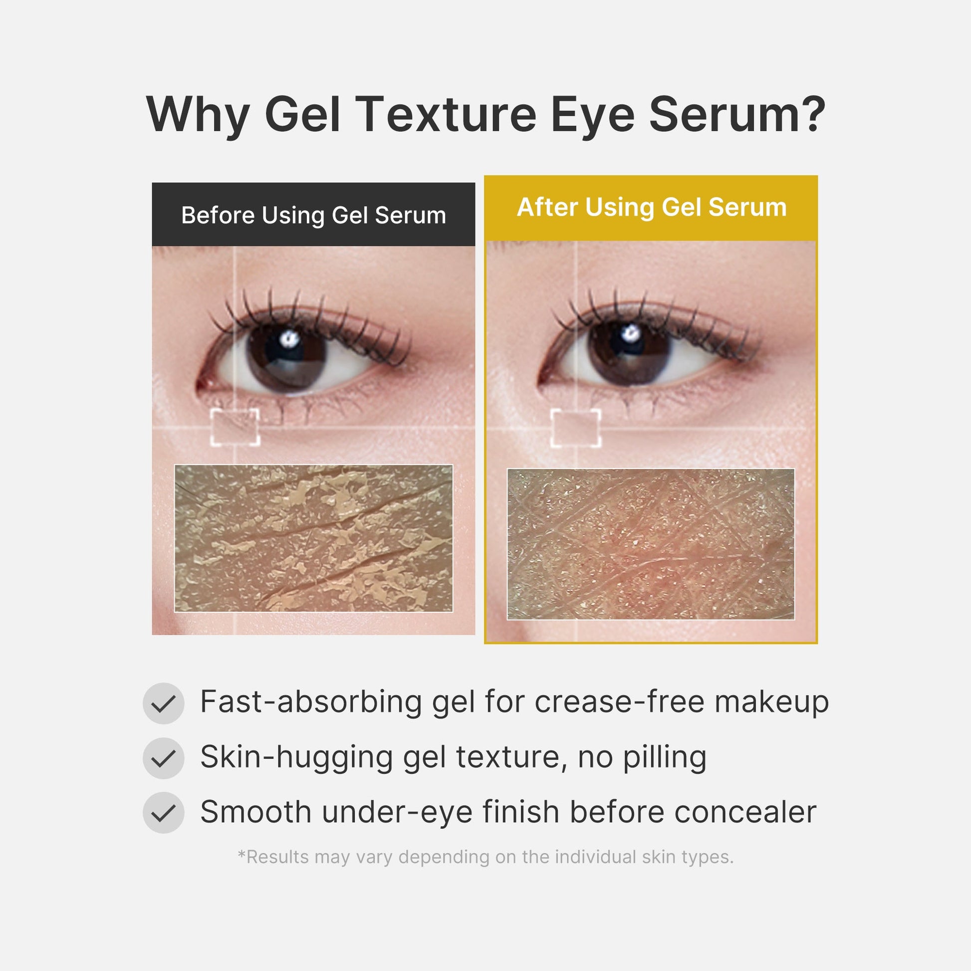 kojic-acid-tumeric-eye-gel-serum-l7 04_0487ef36-49f4-4294-8049-bb55118b05fe.jpg