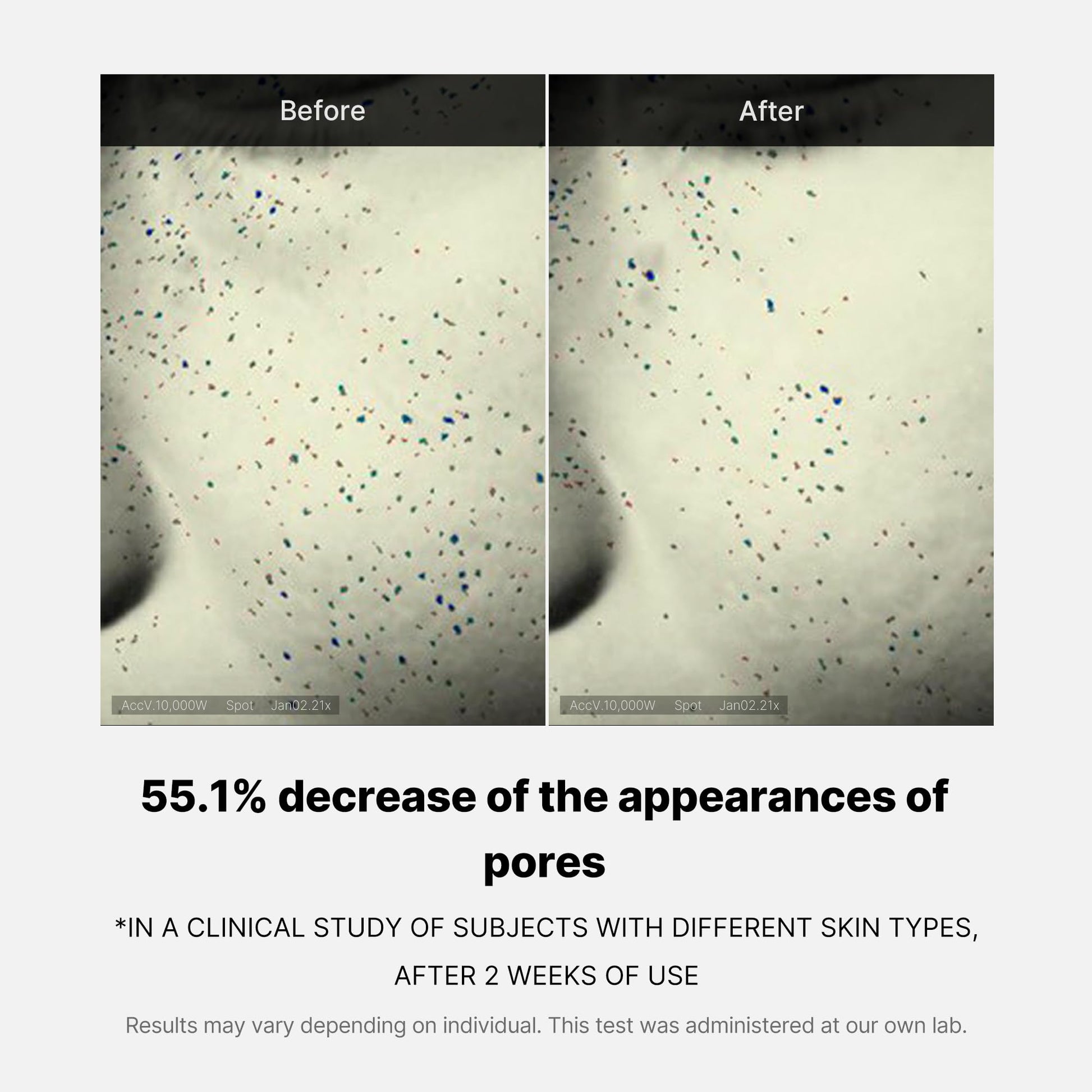 zero-pore-one-day-cream-q3 04_3616addc-f184-4deb-a5d7-e3a782e4713d.jpg