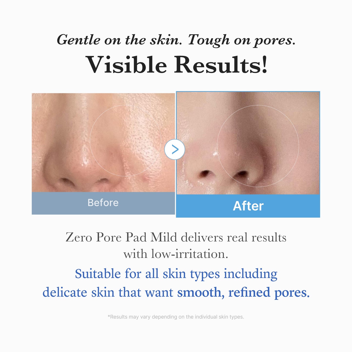 zero-pore-madecassoside-pads-mild-l4 04_6357f9f9-483b-4891-82c6-a58d336e62c8.jpg