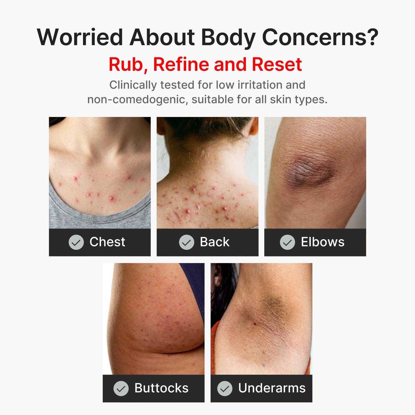 kojic-acid-turmeric-body-peel-shot-k2 04_8a7237f2-3ebf-401e-bd85-54841aeb3efc.jpg