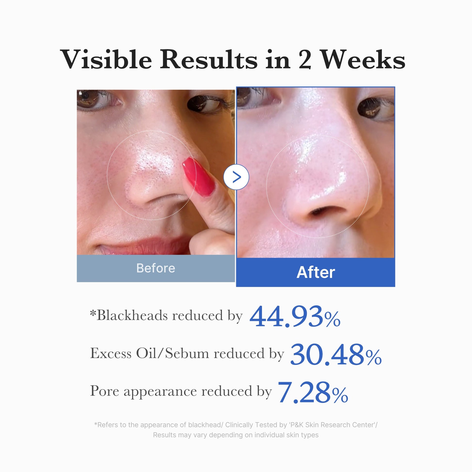 zero-pore-pads-j6 04_9349c00e-d77c-4297-ae8c-05077b182f2b.jpg
