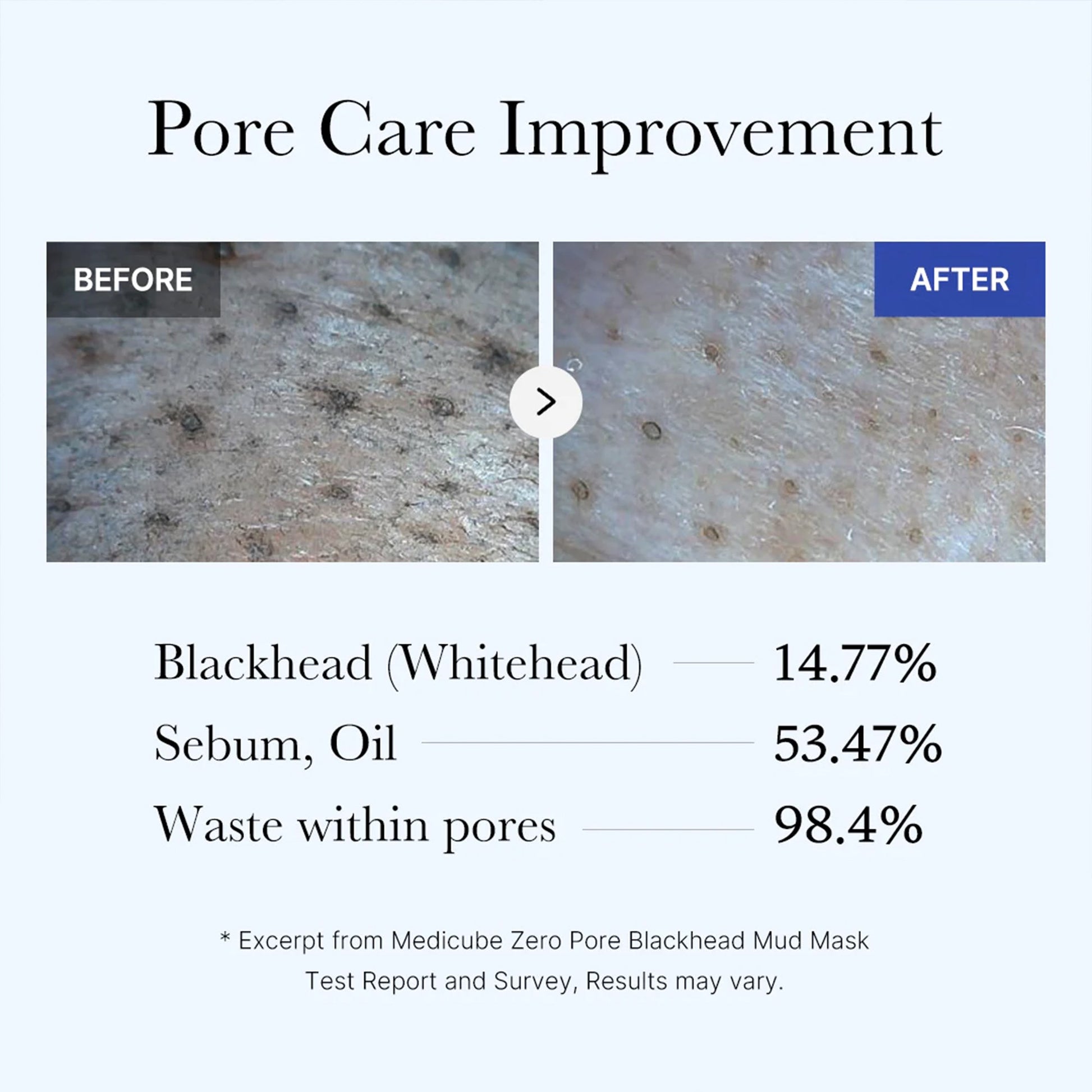 zero-pore-blackhead-mud-mask-a4 05_9362a158-c2b3-4525-acc0-631a2cfdea47.jpg