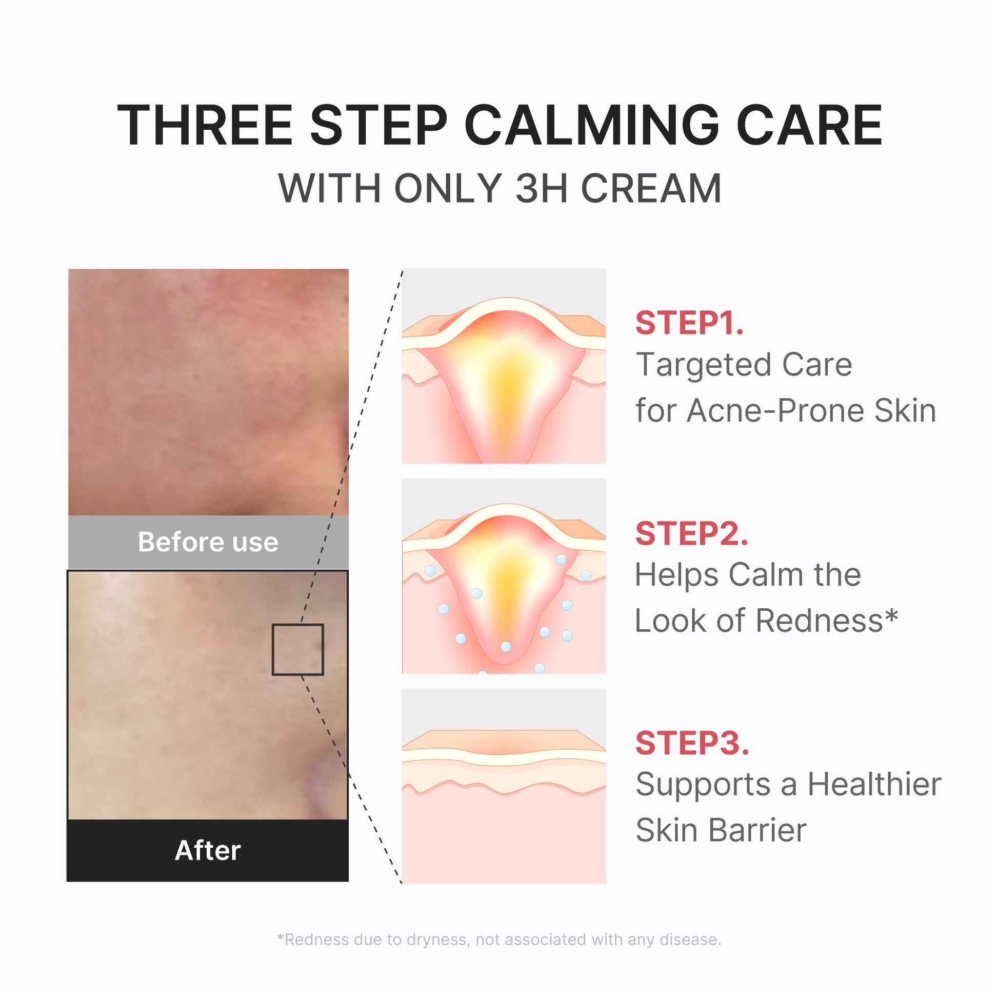 3h-daily-relief-cream-h4 3H_04.jpg