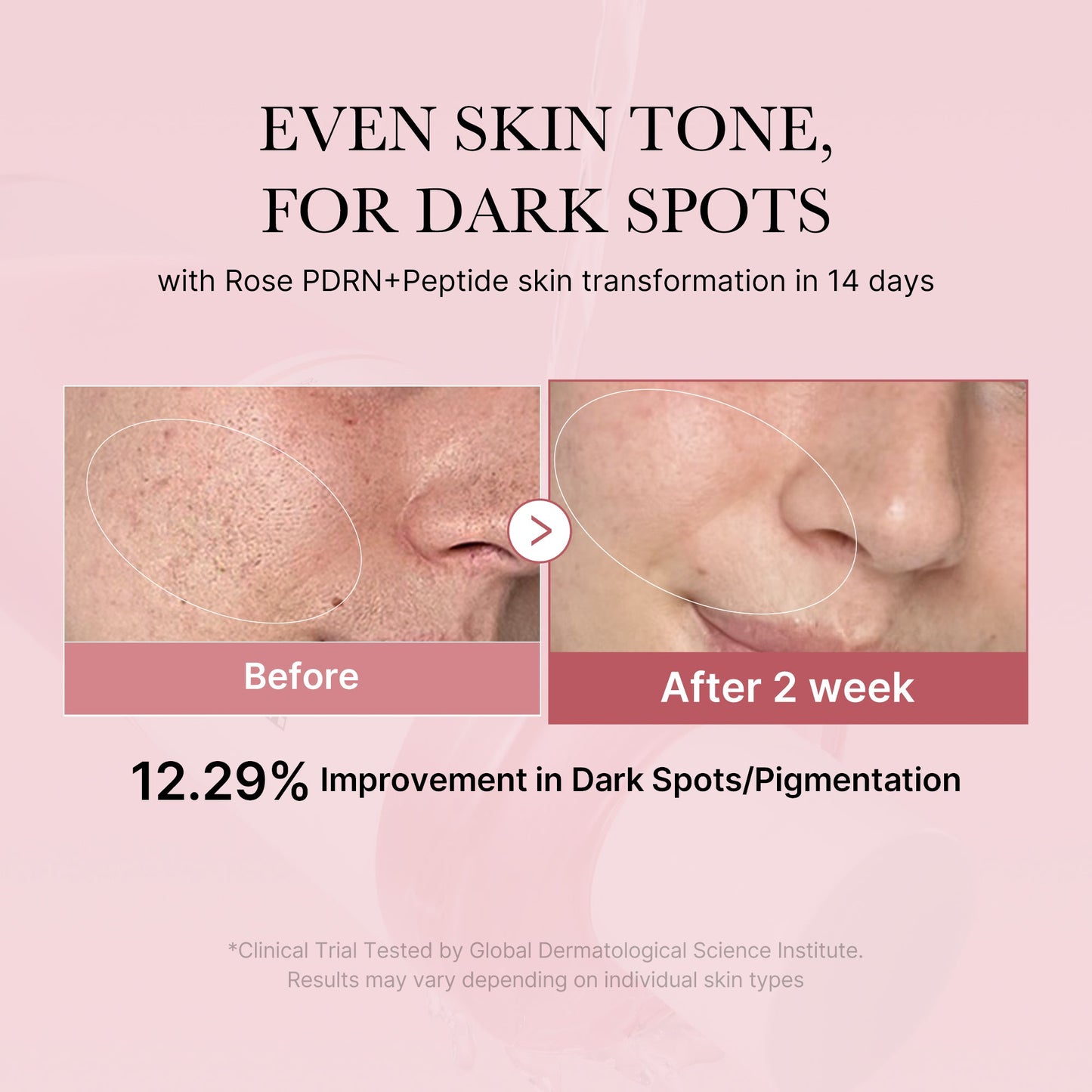 pdrn-pink-peptide-toner-s6 PDRN_01_308c518e-5ac6-4e54-99bd-eabc8796739b.jpg