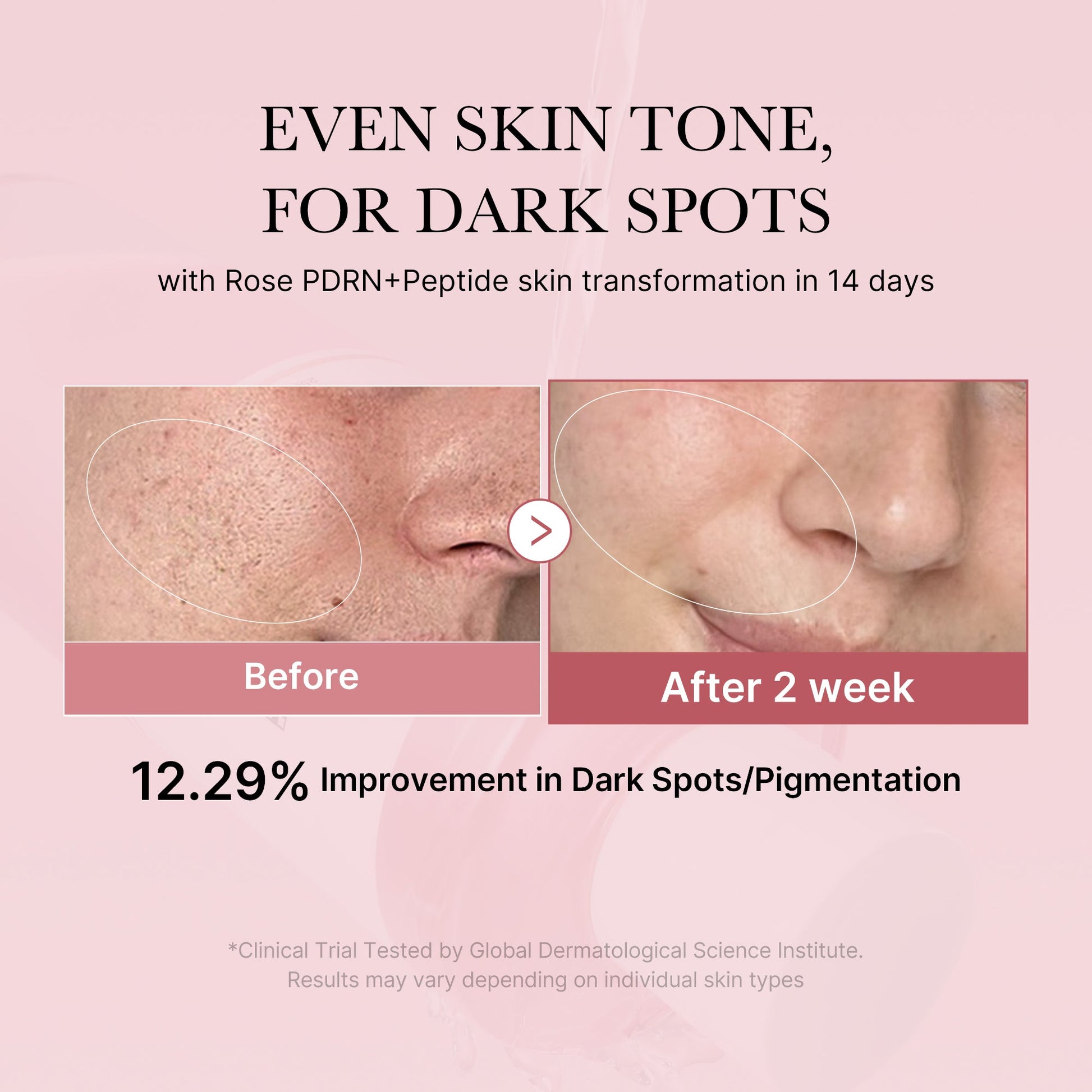 pdrn-pink-peptide-toner-s6 PDRN_01_308c518e-5ac6-4e54-99bd-eabc8796739b.jpg