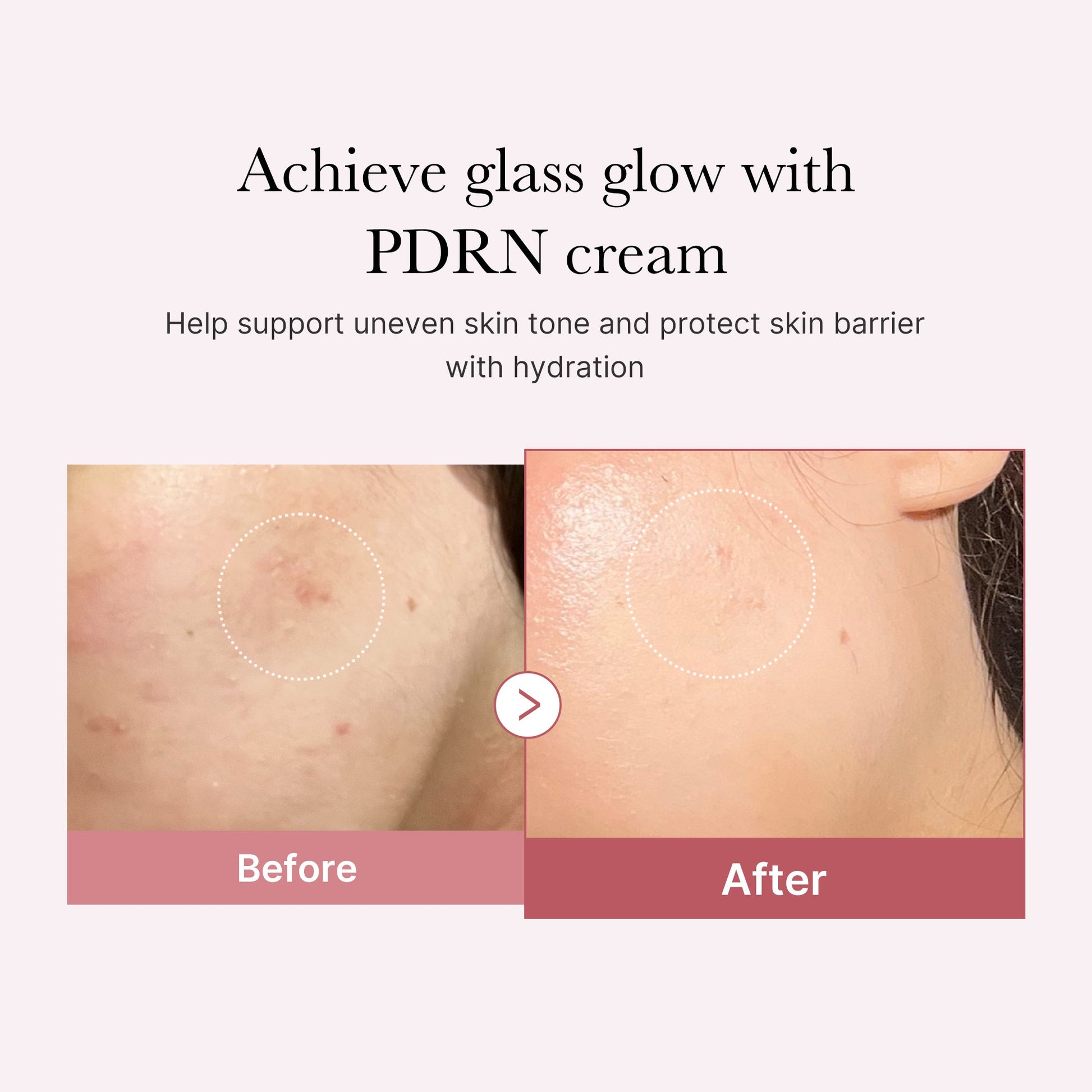 pdrn-pink-peptide-cream-c6 PDRN_02_d7805bfe-cf43-446a-b71b-a276683f136b.jpg