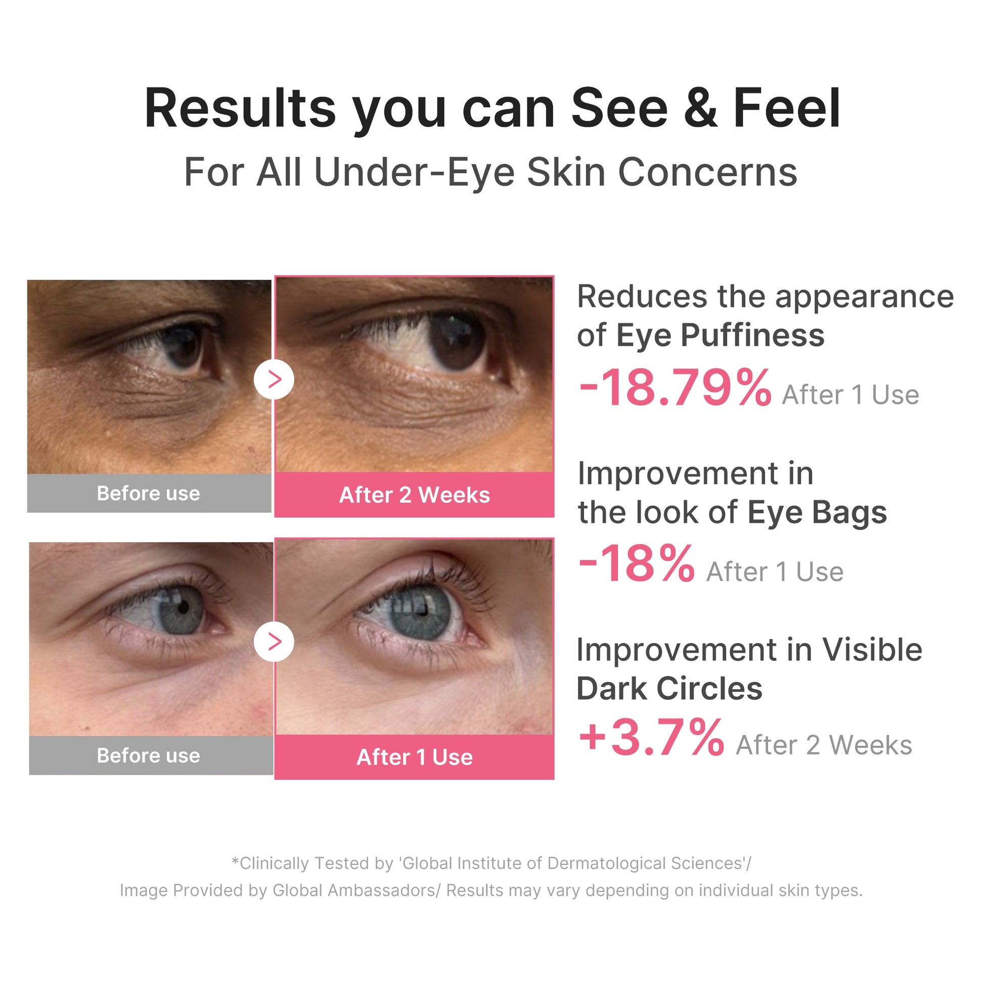pdrn-caffeine-collagen-eye-patch-n1 PDRN_03_cdce2143-b8d8-43cb-ac69-fcbdf6640249.jpg