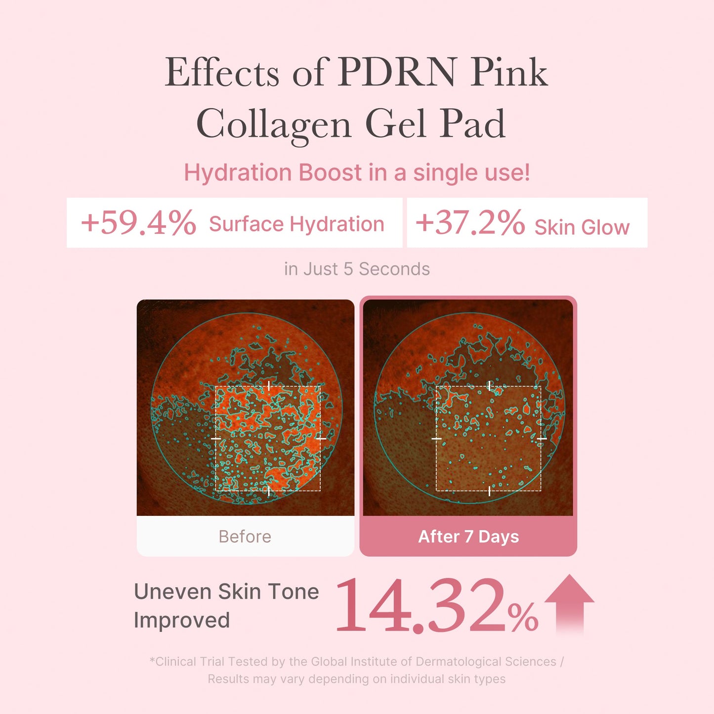 pdrn-pink-collagen-gel-toner-pad-r9 PDRN_04_f9a16a56-8d9e-4c47-a635-ed34ec3ed571.jpg