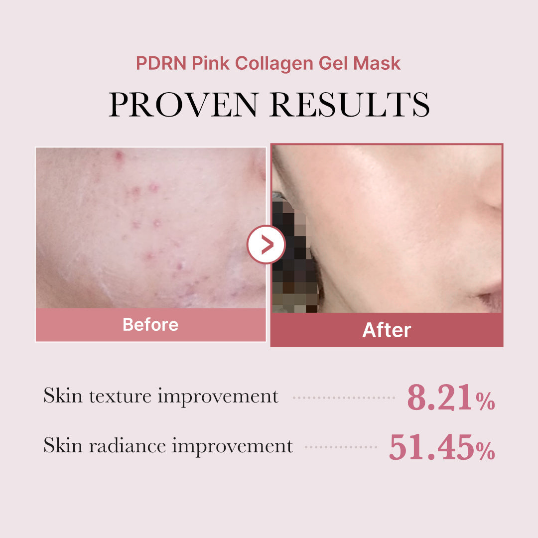 pdrn-pink-glow-full-set-b1 PDRN_12.jpg