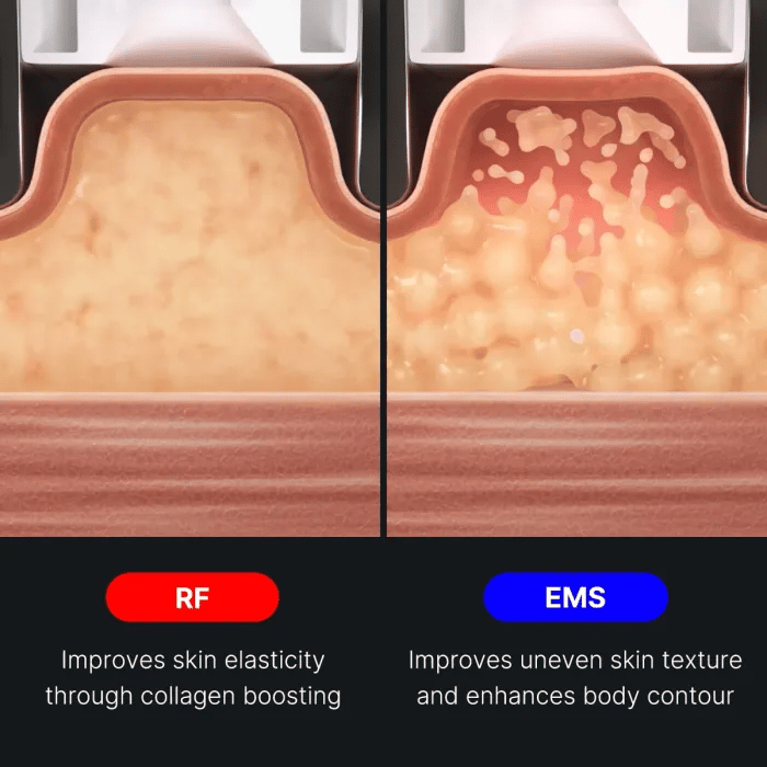 age-r-contour-body-shot-r1 img.webp